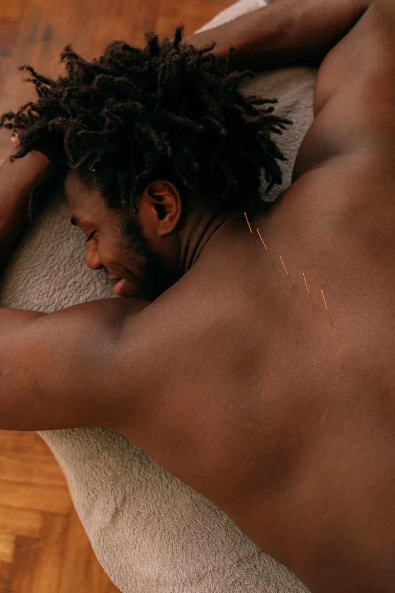 Acupuncture at VitalNura Wellness, Kampala